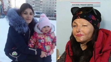 Кислота требует жертв 26.10.2018