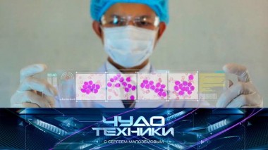 Возможности стволовых клеток, выбор подержанной техники и «умные» двери 24.02.2023