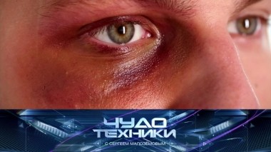 Средства от синяков, выбор соковыжималки, рюкзак-антивор и велосипед для подводных заплывов 28.08.2019