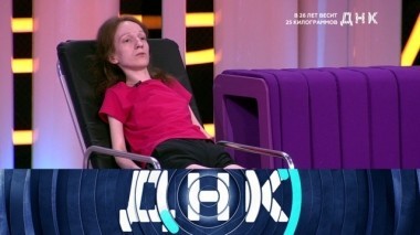 В 26 лет весит 25 киллограммов 02.10.2018