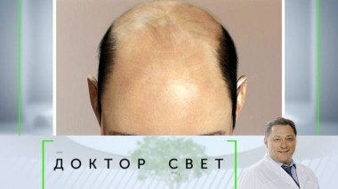 Почему люди лысеют и как проявляется психологическая защита 28.11.2019