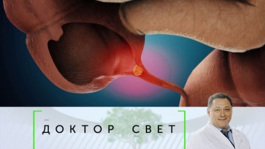 Причины аппендицита, все о кишечной флоре и помощь при боли в животе 22.05.2020