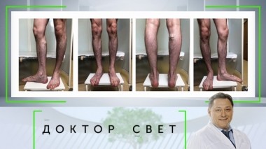 Варикозное расширение вен и тяжелый характер у пожилых людей 20.06.2019