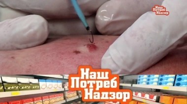 Все о родинках и бородавках, чудо-упражнения для похудения и проверка сыра с голубой плесенью 09.02.2019