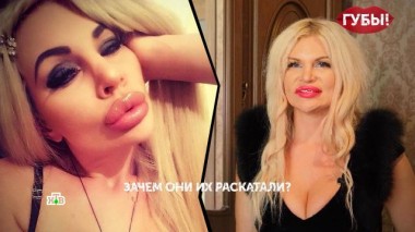 «Губы». 1 серия 09.08.2023