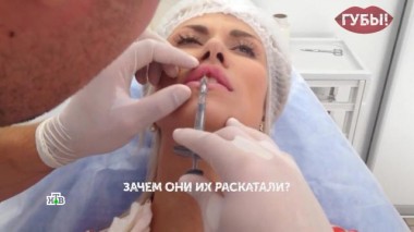 «Губы». 3 серия 16.08.2023