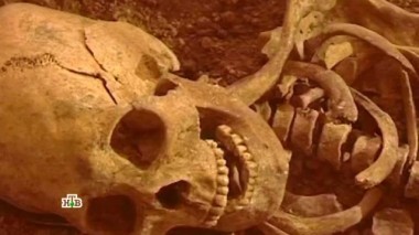 Загадочные черепа или опыты над человечеством? 01.02.2017