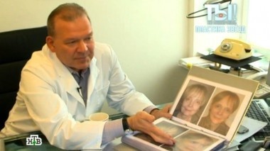 Пластический хирург для знаменитостей, темное прошлое Натали и племянник Гайдая 04.01.2014