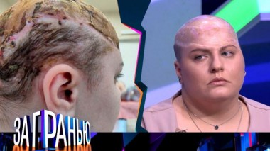 «Девушка без скальпа» 12.02.2025