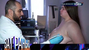 «Грудь весом 25 кг» 14.02.2024