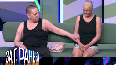 «Любовь вопреки диагнозам» 20.05.2026