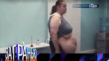 «Не жизнь, а грыжа» 19.06.2024