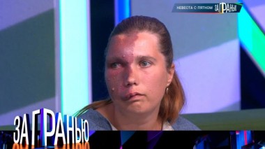 «Невеста с пятном» 09.09.2024