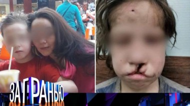 «Отчим и мать изуродовали сына!» 10.12.2024