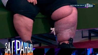 «Папа весом 238 кг» 06.04.2024