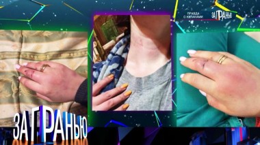 «Правда с кулаками» 31.01.2024