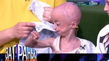 «Стареют не по годам!» 13.04.2025