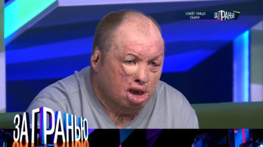 «Сжёг лицо сыну» 15.09.2025