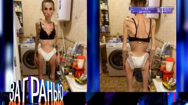 «Кожа да кости» 11.10.2022