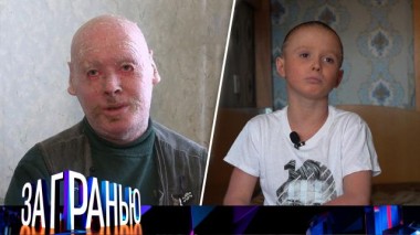 «Покрылись чешуей» 16.12.2021