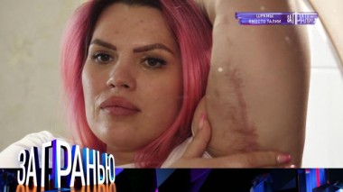 «Шрамы вместо талии» 16.05.2022