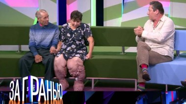 Слоновья болезнь 29.09.2021