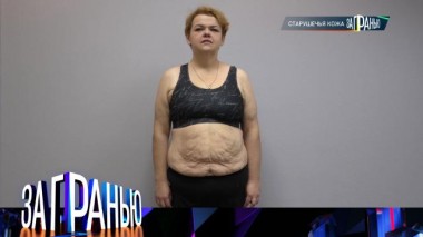 «Старушечья кожа» 29.11.2022