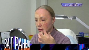 «В два года горела заживо» 19.01.2022