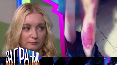 «Воспитывал кипятком?» 28.08.2022