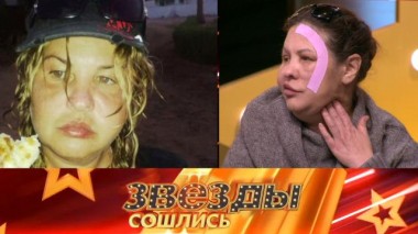 На игле красоты? 08.03.2024